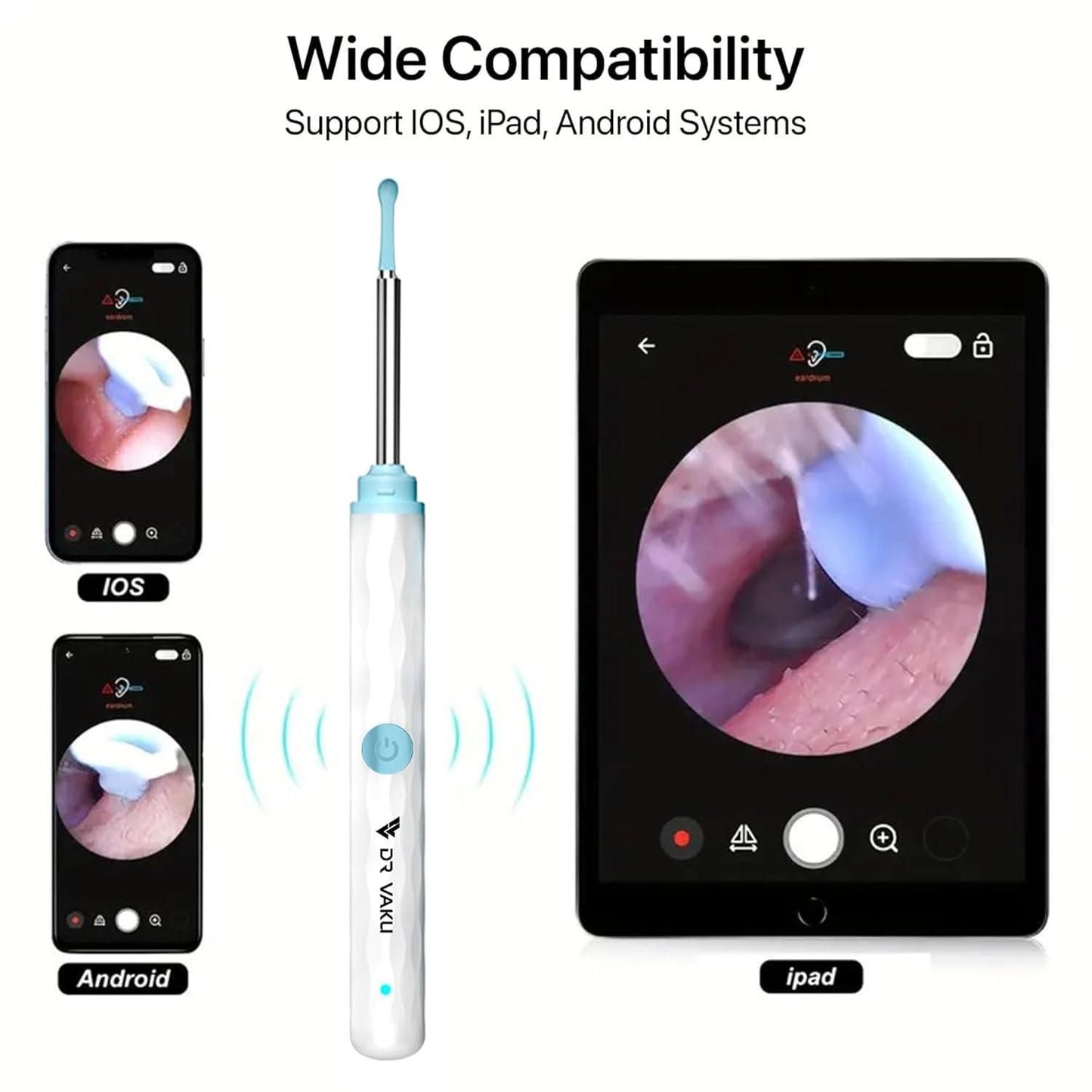 Smart Visual Ear Wax Cleaner nmwwyb-dg