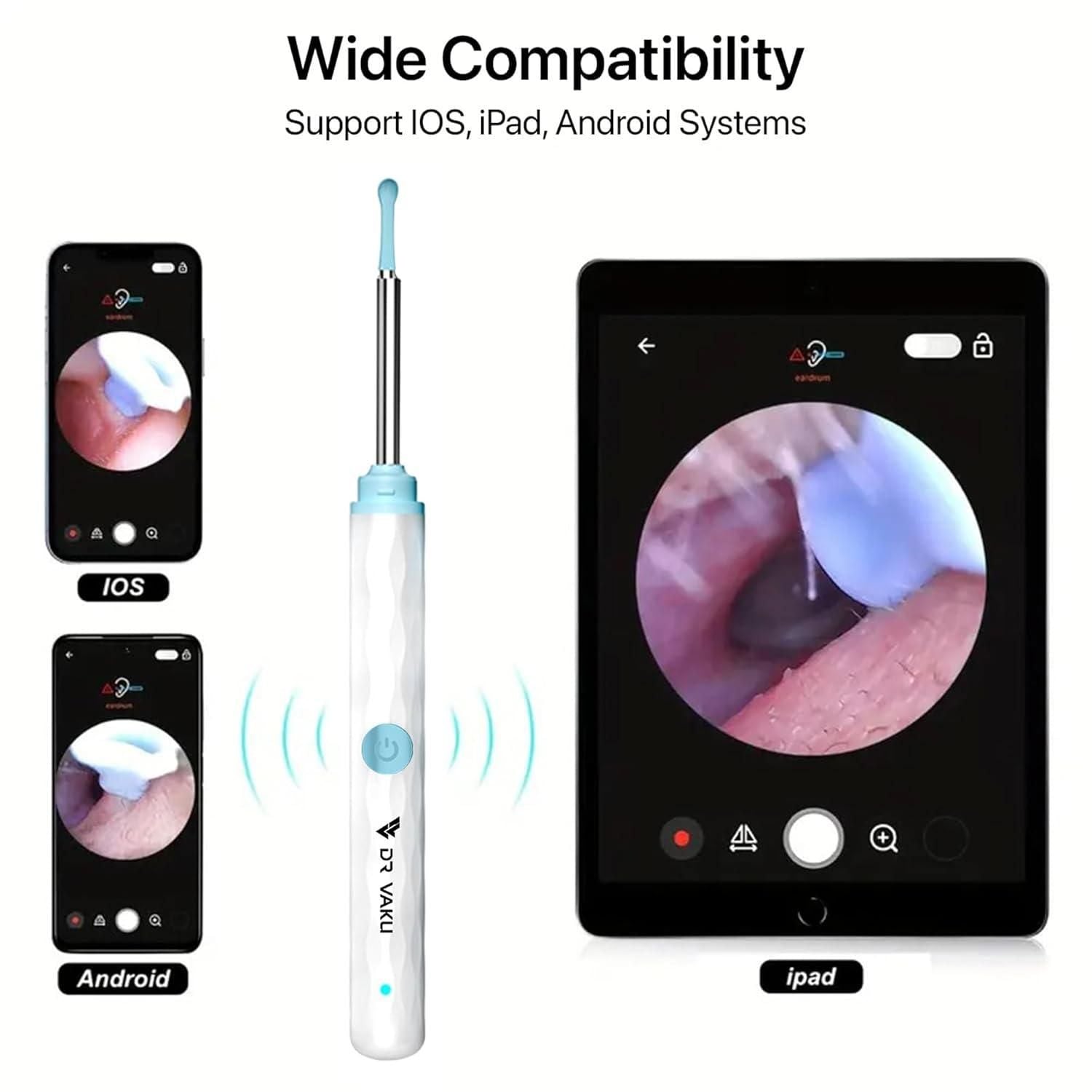 Smart Visual Ear Wax Cleaner nmwwyb-dg