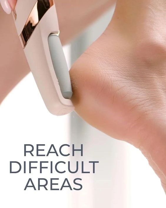 Electronic Cordless Pedicure Callus Dead Skin Remover Polishing Tool nmwwyb-dg